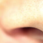 男の「いちご鼻」の改善方法を徹底解説！原因と効果的な対策は？